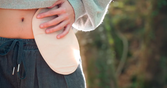 Alimentazione e stomia: consigli pratici per una vita equilibrata